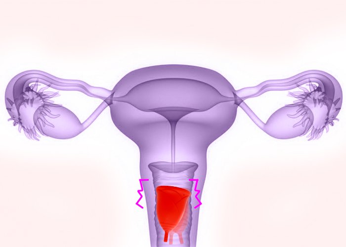 SATISFYER COPA MENSTRUAL FEEL CONFIDENT AZUL CLARO PAQUETE DE 2 - Imagen 3